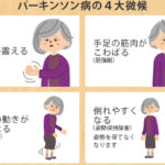 パーキンソン病関連疾患 症状や原因、治療方法は?