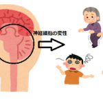 脊髄小脳変性症とは? 症状やリハビリ方法は?