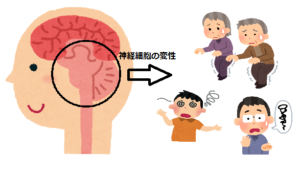 脊髄小脳変性症とは？　症状やリハビリ方法は？