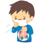 急性肺炎とは？症状や原因、予防や治療方法は？【コロナ感染→肺炎→重度化】