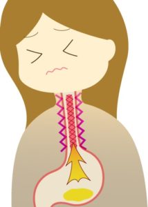 逆流性食道炎とは？ 症状や原因、予防や治療方法は？