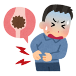 尿路結石（腎臓結石）とは？　主な症状や原因、治療方法は？