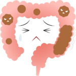 腸閉塞(イレウス)とは? 主な症状や原因、治療方法は?