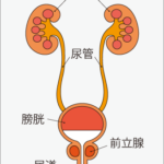 前立腺がんとは？　主な症状や原因、治療方法は？