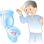 膀胱がんとは？　主な症状や原因、治療方法は？